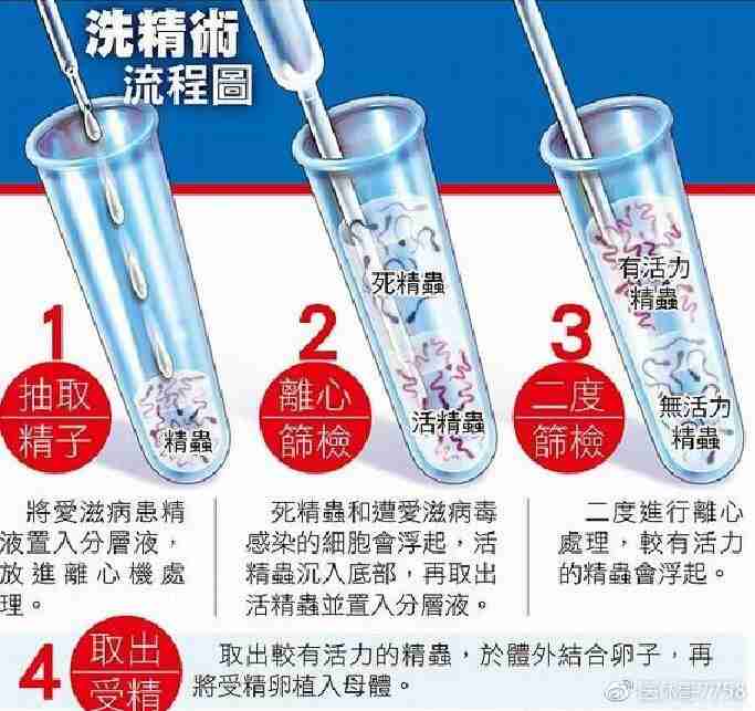 供卵试管婴儿是否适用于45岁以上的夫妇