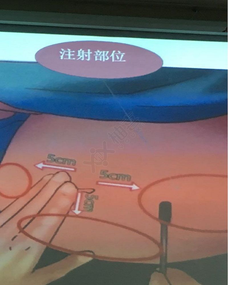 供精三代试管男性精子排出时间
